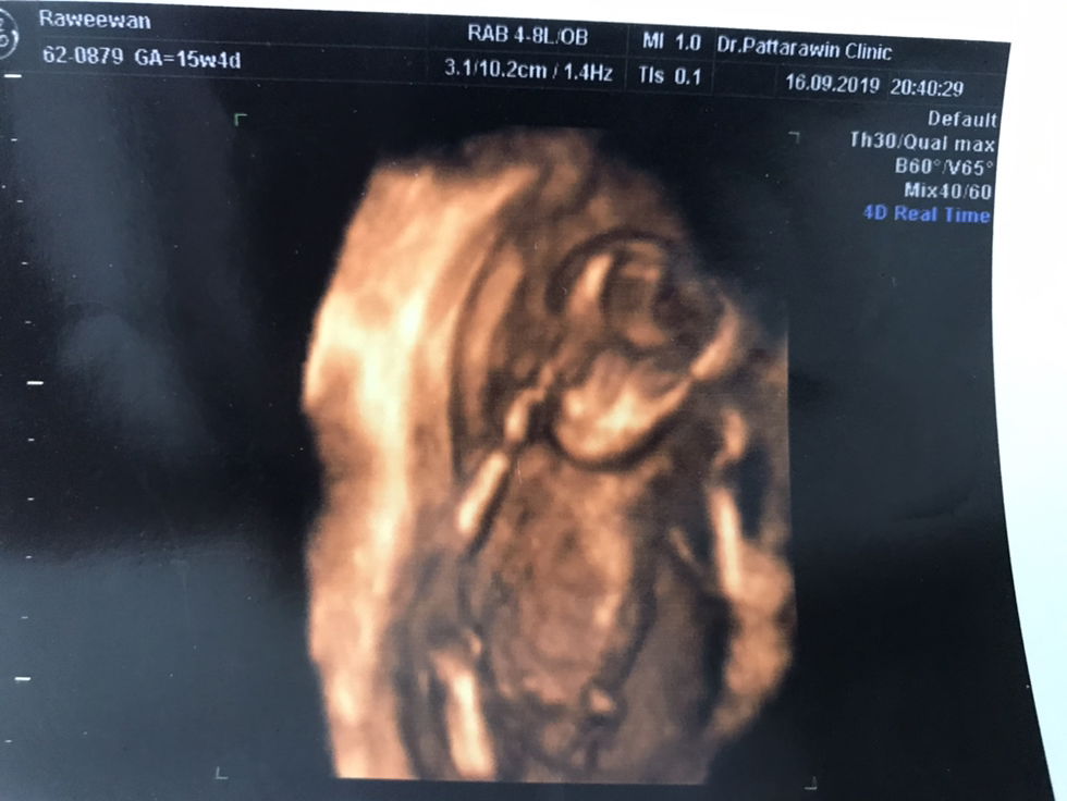 ตั้งครรภ์