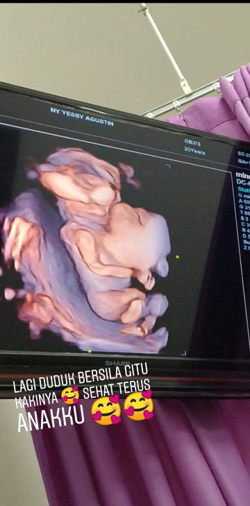 hasil usg 4dimensi 18w 2d