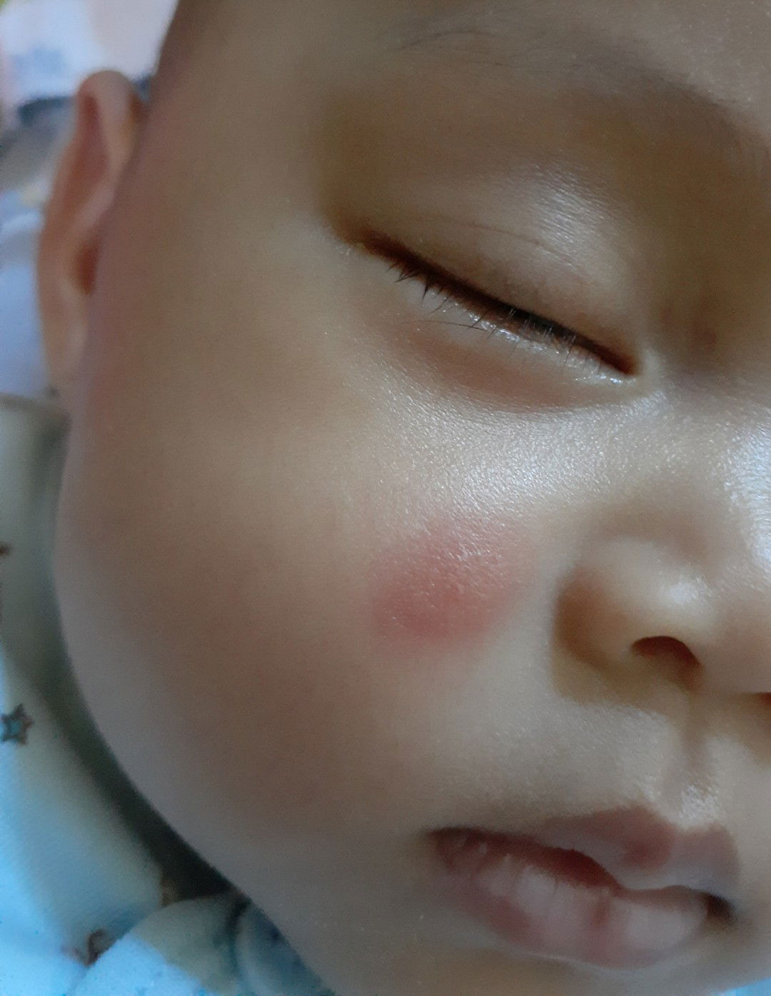 bentol besar dan keras