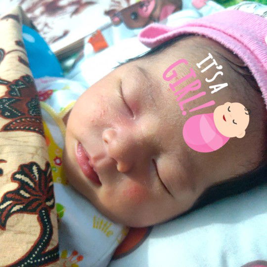 bintik merah di pipi