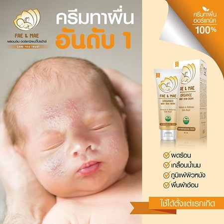ครีมทาผื่น