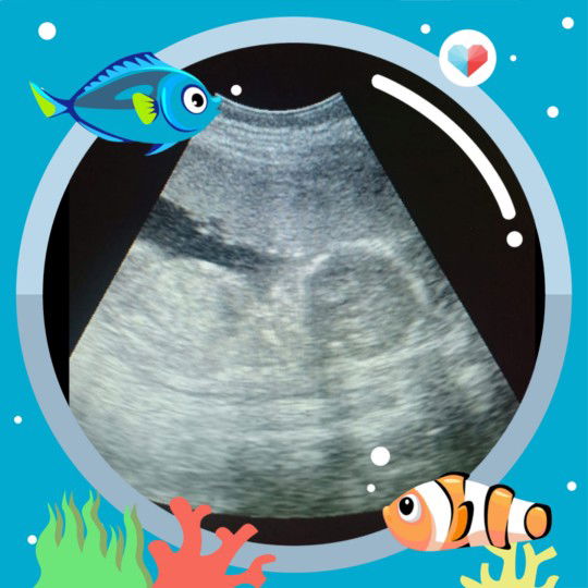 bagi pengalaman dong bun ?