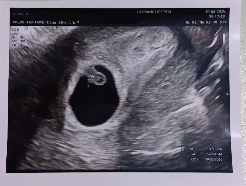 Palakorn Jame Promchai profile icon