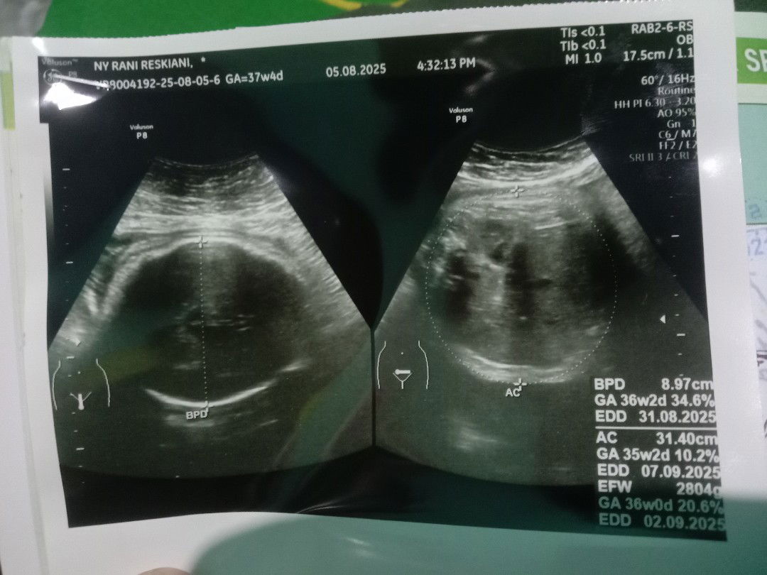 Rani Restiani  profile icon