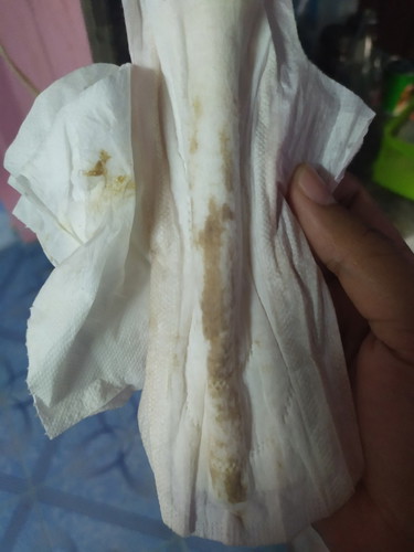 มีมูกสีน้ำตาล?