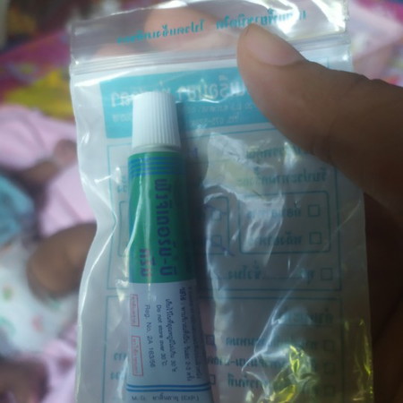 น้องเป็นเกลื้อนน้ำนม