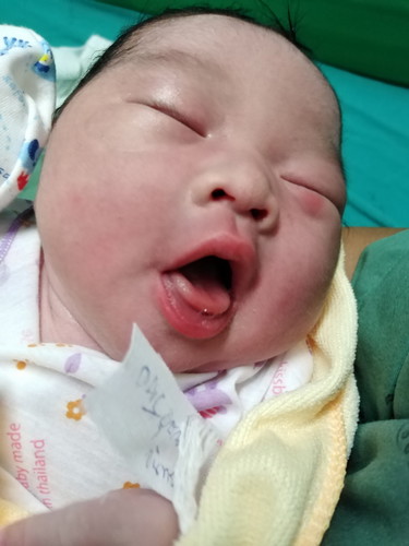 40+2เลยกำหนดคลอดมา1วัน