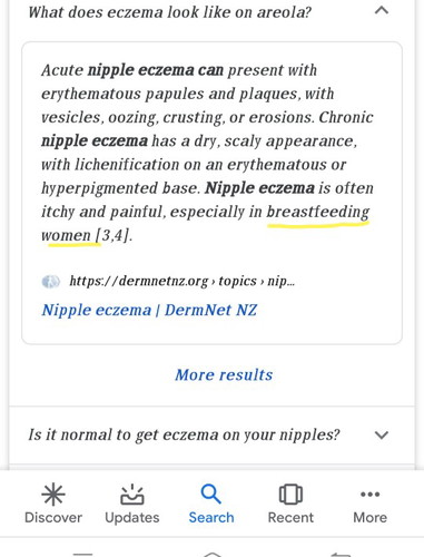 Nipple eczema