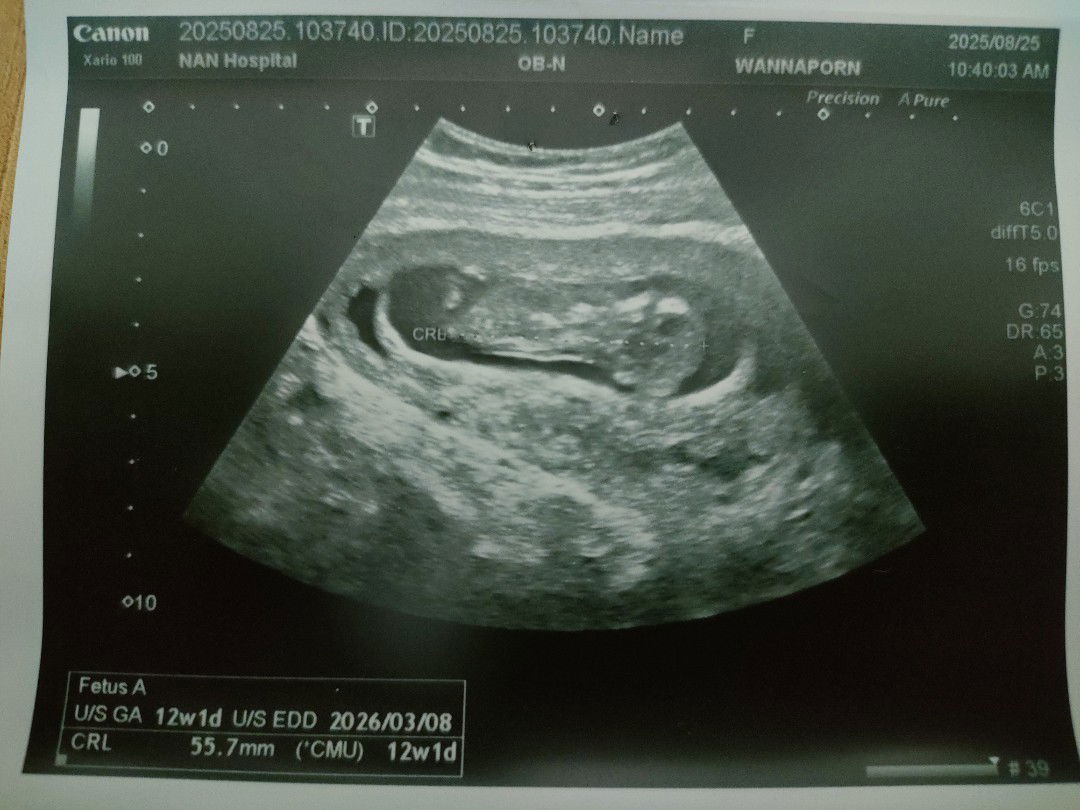 Apple Tipkritar profile icon