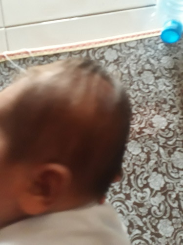 มีวิธีแก้หัวลูกแบนมั้ยคะ