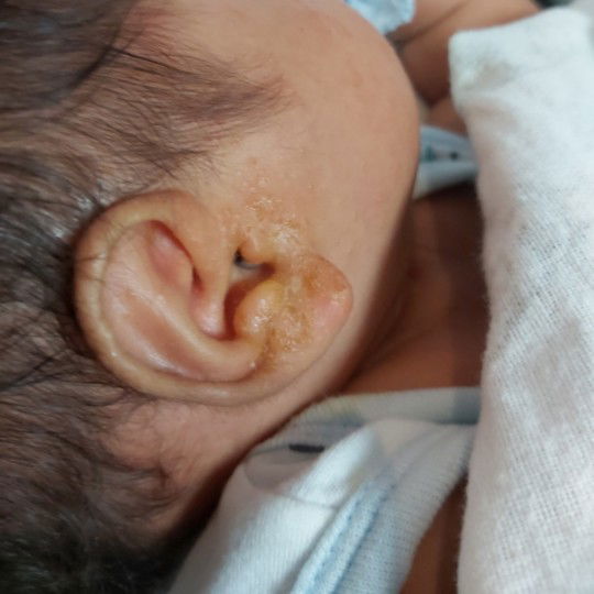 Worried lang po kami ninmomy