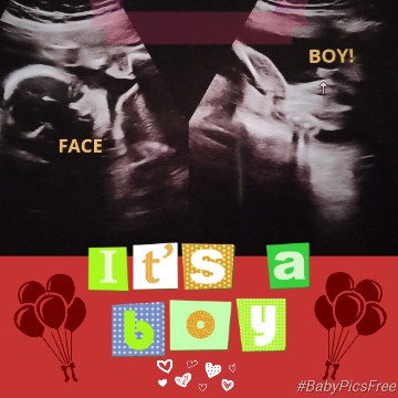 Its a boy