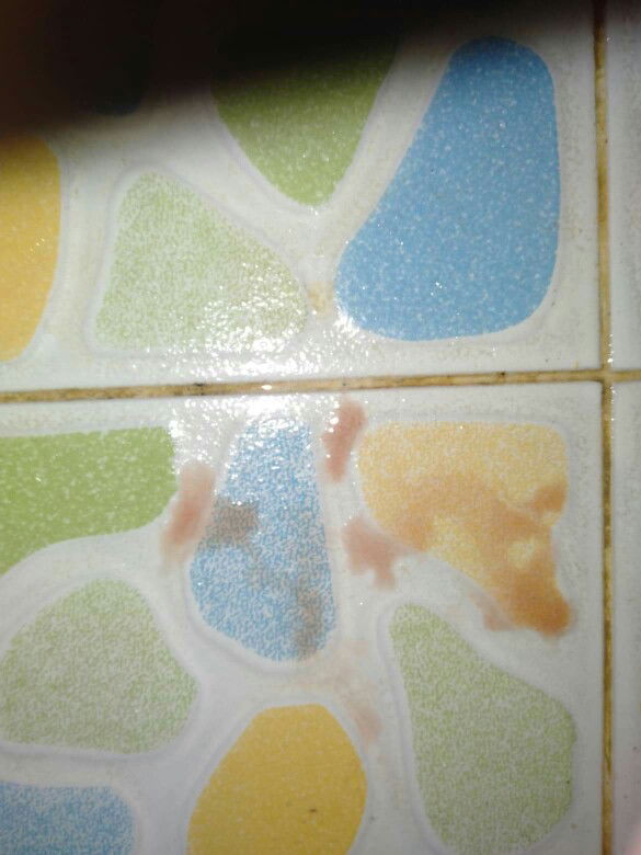 ท้องลม.ภาวะเเท้งคุกคาม