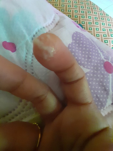 cervical mucus