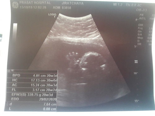 ความยาวของลูก