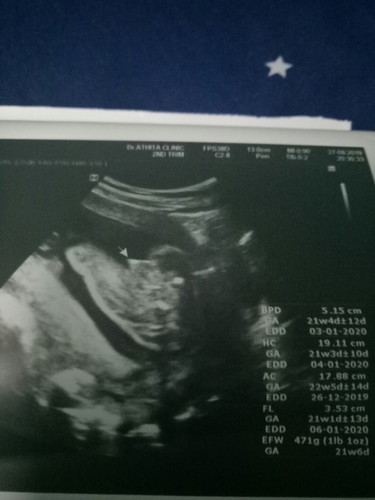 ถามหน่อยค่ะ