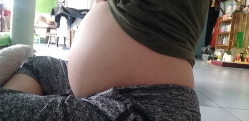 มีลูกบ้านไหน หนีบเก่งบ้างไหมคะ หรือว่าอายหมอ☺️