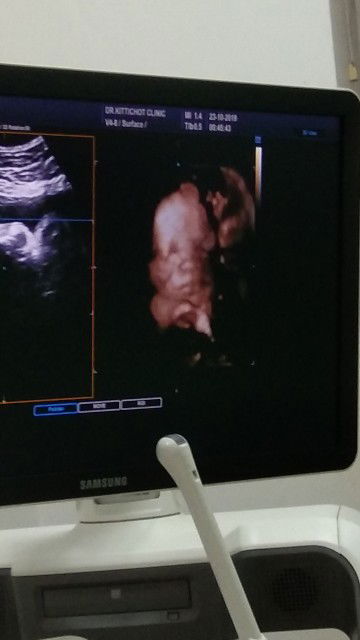 ตั้งครรภ์