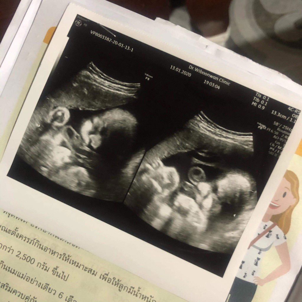 Cha-cha profile icon