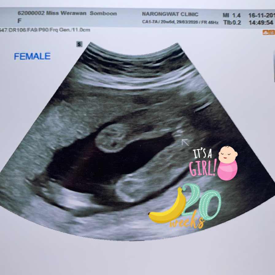 ได้ลูกสาวค่ะ