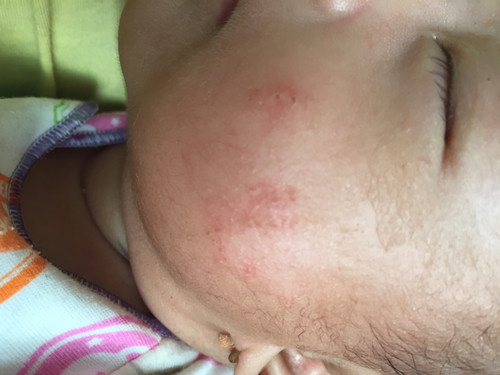 Obat apa