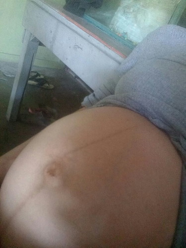 37วีค5วันท้องแข็งบ่อยมาก