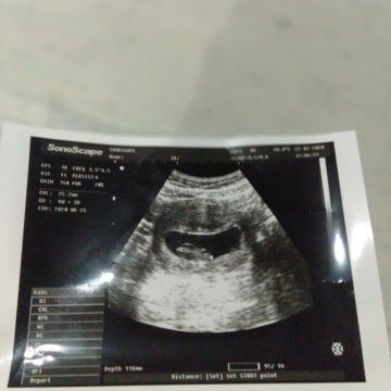 berbagi pengalaman yuk