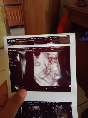 31 week