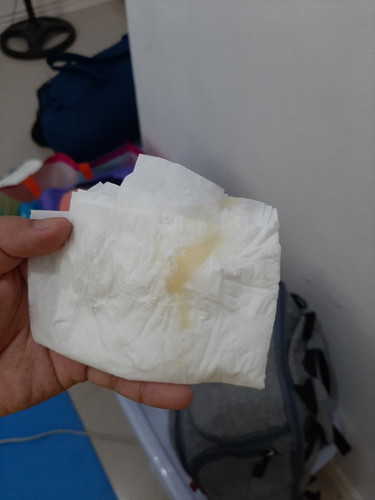 yellowish discharge 38 weeks