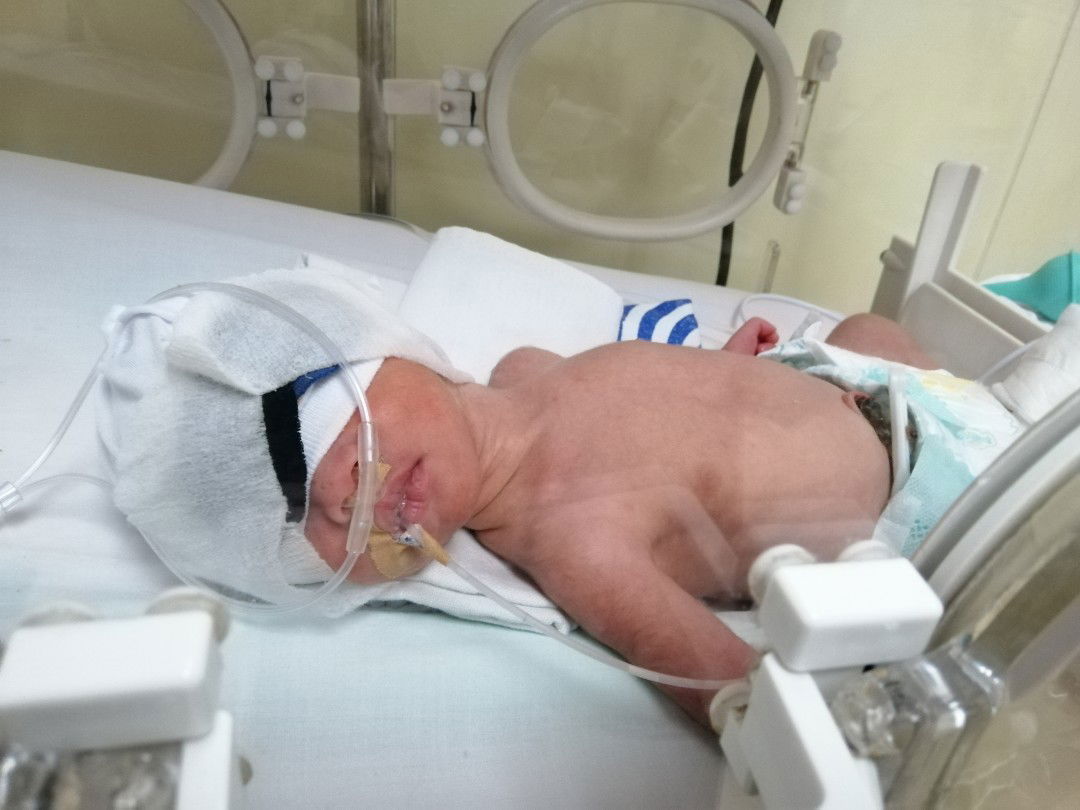 My 7 Days Old Preemie Baby ?