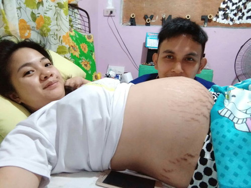 34weeks tomorrow