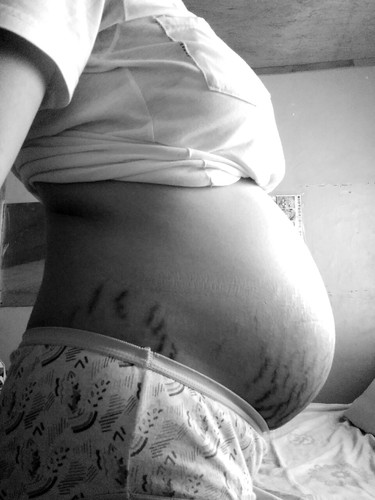35weeks and 3 days