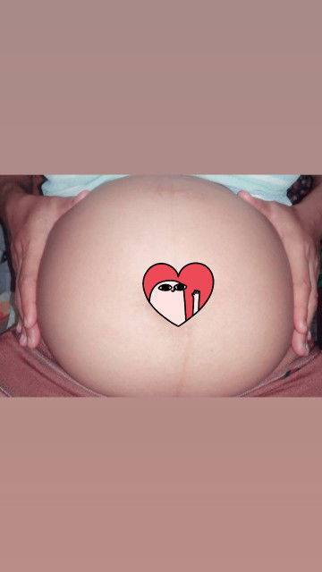 Usia kandung 26 week sudah keluar air susu