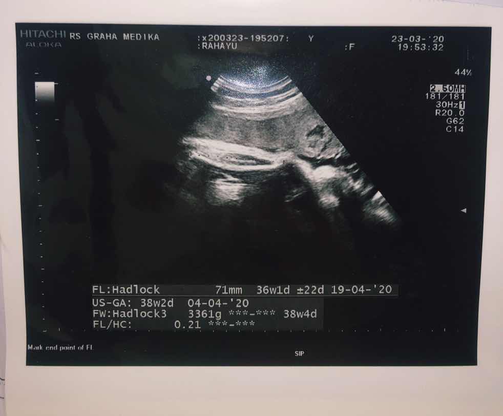 Lahir dengan Induksi