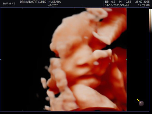 Nutsara Chamsom profile icon