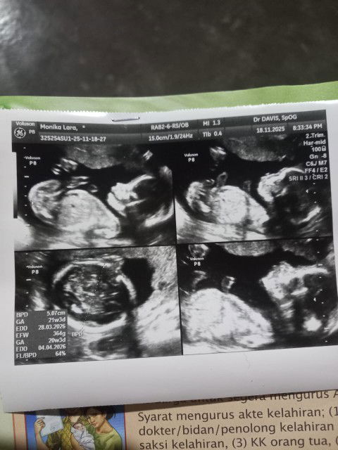 Monika larasendy profile icon