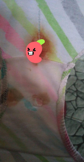 Mamsh, there is a blood ?