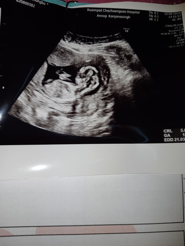 มีแม่ๆบ้านไหน ซาวเพศผิดไหมคะ