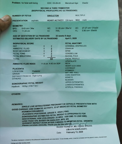 Good Day. Maliit daw po si BABY