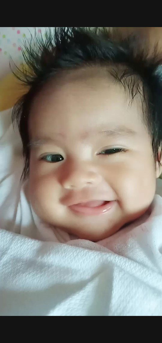 Nalagyan ng tubig na may lactacyd yung mata ni baby