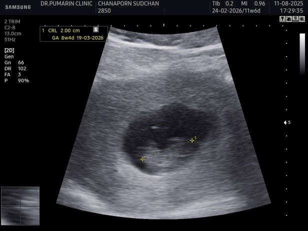 Howong Buakwan profile icon