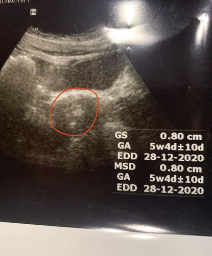 เหมือนเจอถุง