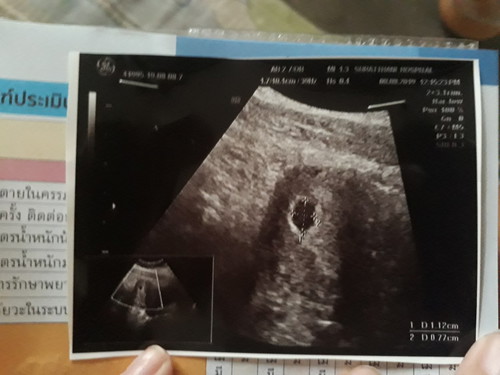 สอบถามจากคุณแม่ท่านอื่นๆค่ะ