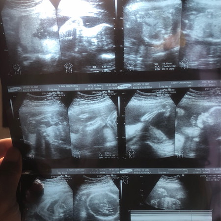 🤰🏻🤰🏻🤰🏻