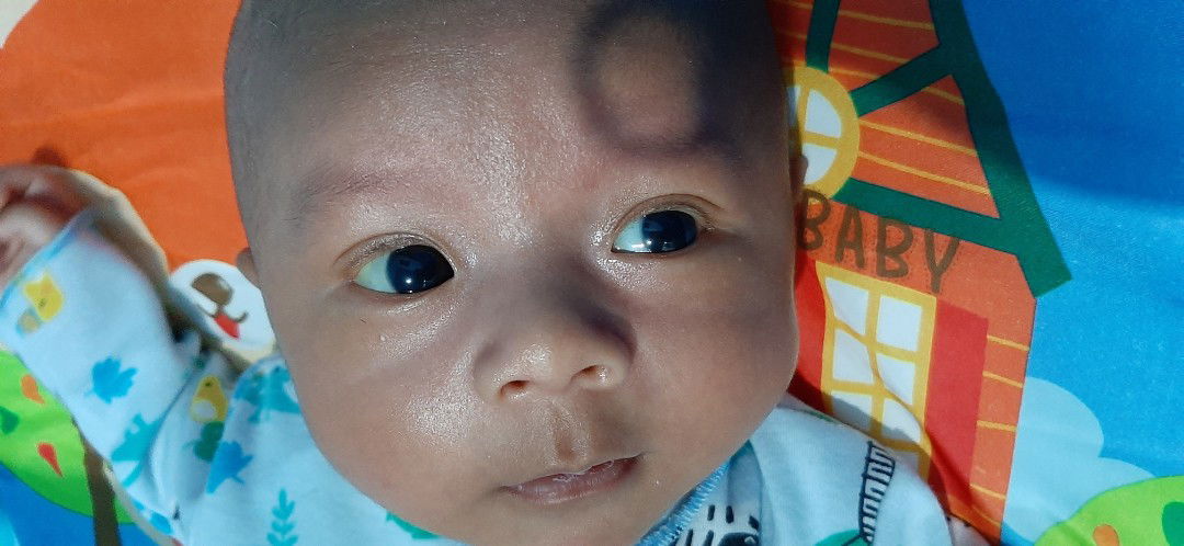 Bayi 50 Hari masih kuning