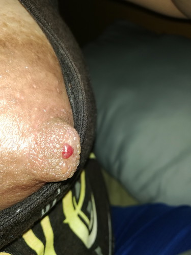 help please