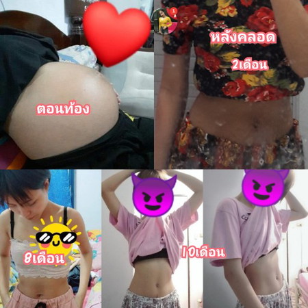 หน้าท้องไม่ดำไม่เหี่ยวแล้ว มาแนะนำการออกกำลังกาย และดูเเลหน้าท้องง่ายๆ