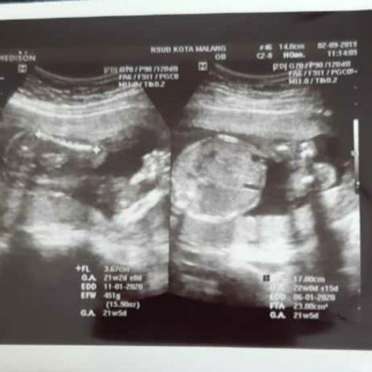 mommy tangguh profile icon