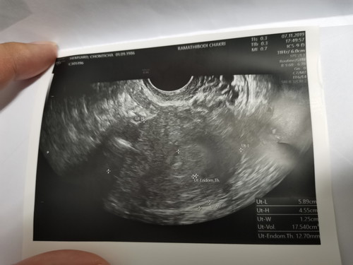 แม่ๆ เจอเด็กน้อยกันกี่วีคคะ