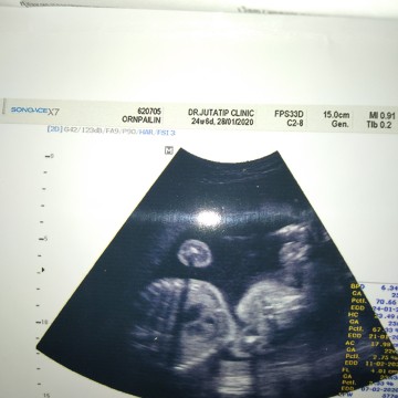 รบกวนแม่ๆหน่อยค่ะ